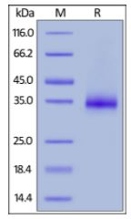 Human CD2, His Tag on SDS-PAGE under reducing (R) condition. The gel was stained overnight with Coomassie Blue. The purity of the protein is greater than 95%.